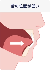 舌の位置が低い