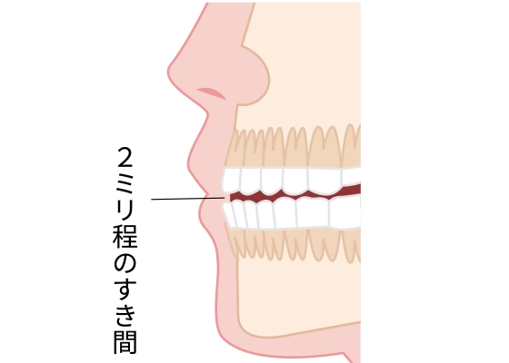 理想のお口バランス 歯